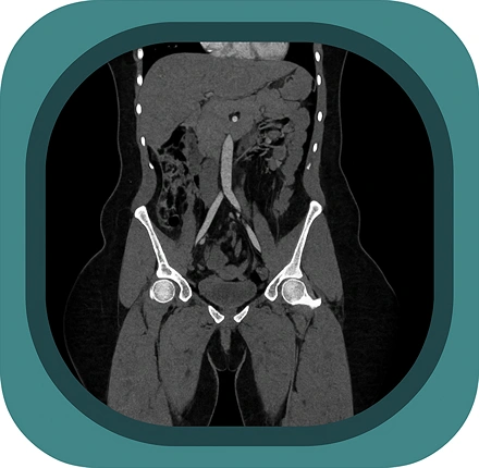CT abdomen icon